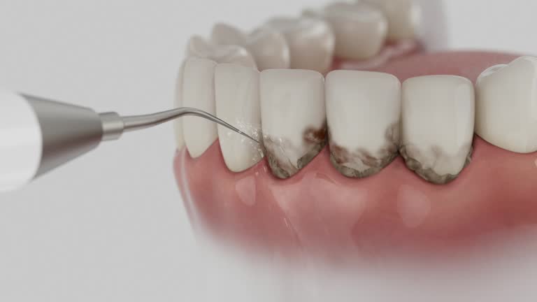 Reliable Teeth Cleaning And Checkup contractor in Amarillo, TX by Smile Center Dentistry
